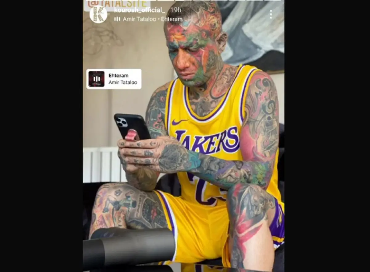 اهنگ امیر تتلو جوجه هنری