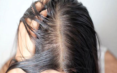 روش های از بین بردن موهای چرب چیست؟