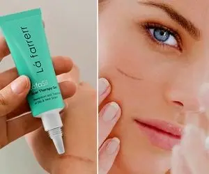 بهترین کرم ترمیم کننده واسه دماغ عملی ها و سوختگی لیزر و برداشت خال / راز پوستی صاف