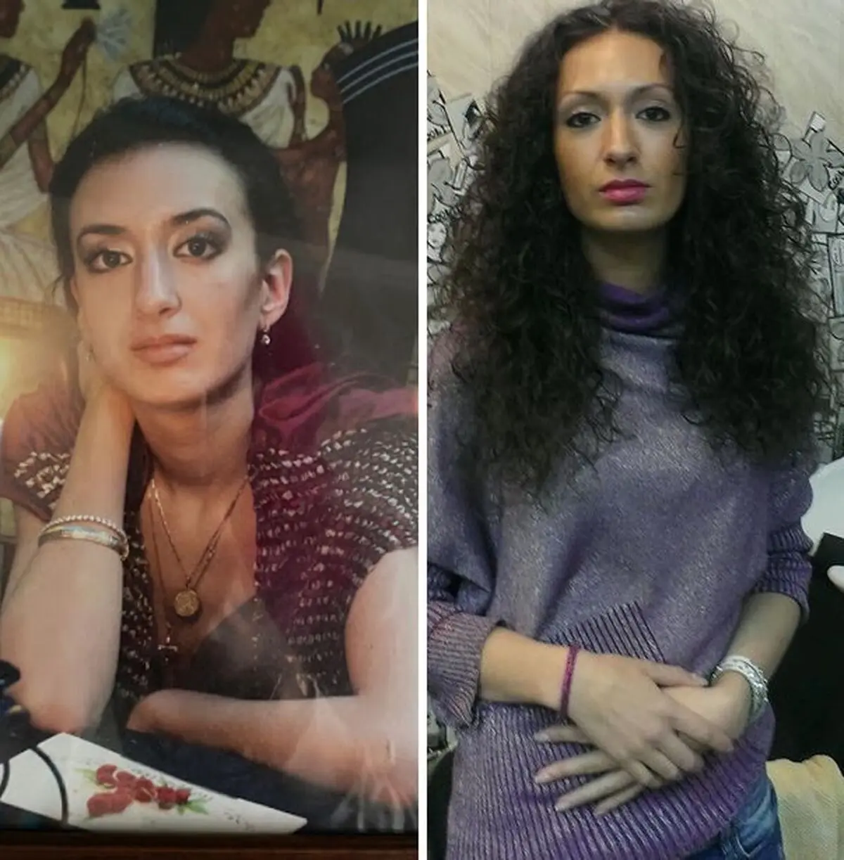 (عکس) آناستازیا پوکرشچوک زنی با بزرگترین گونه و جراحی های زیبایی عجیب!