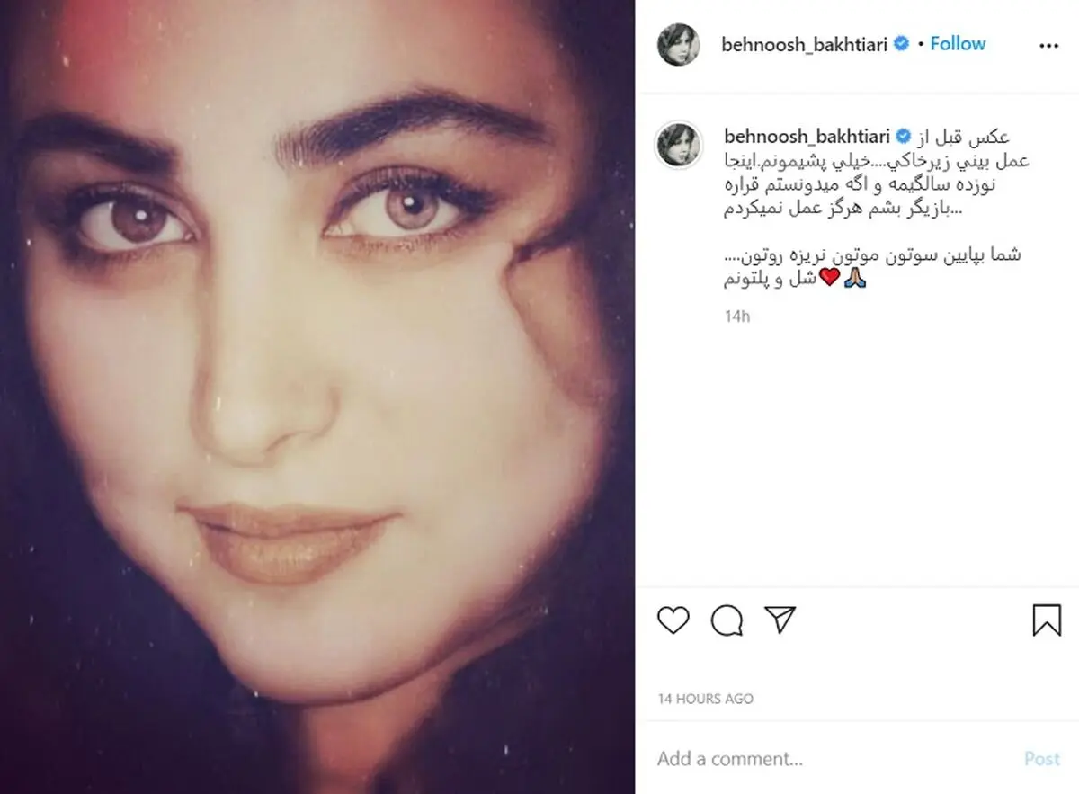 (عکس) بهنوش بختیاری قبل از عمل بینی؛ خیلی پشیمانم!