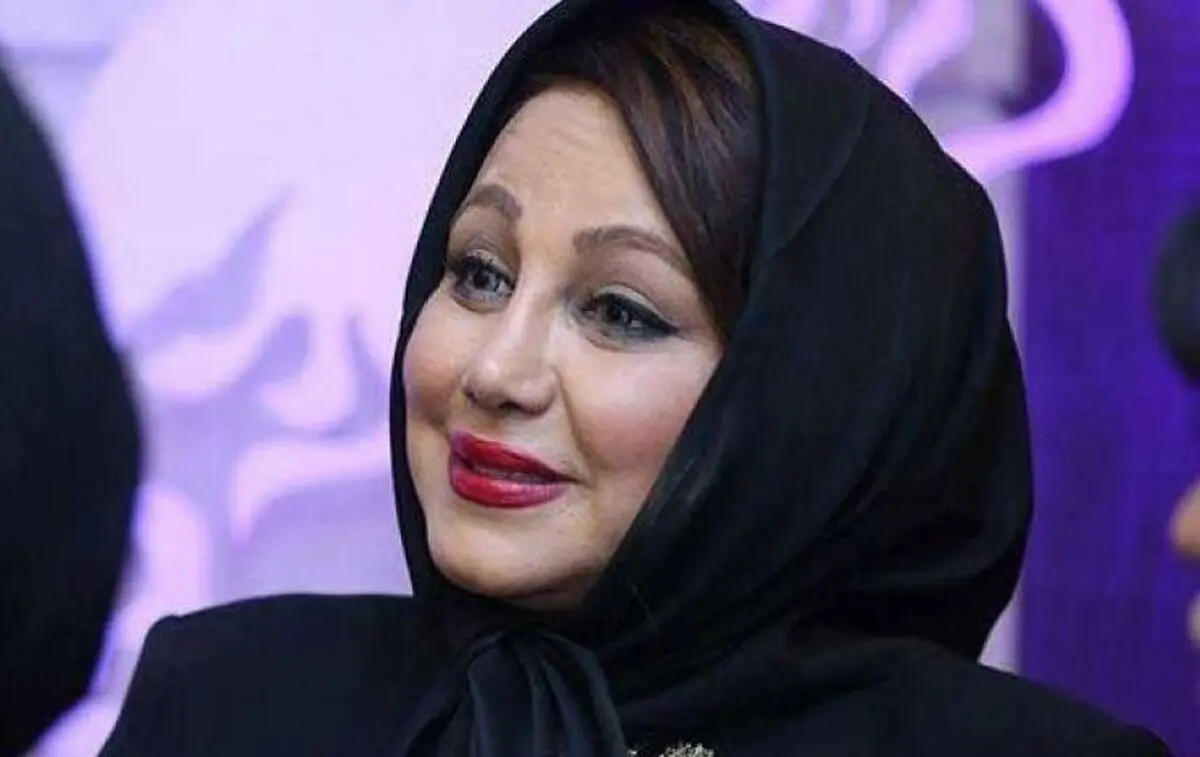 (عکس) بهنوش بختیاری قبل از عمل بینی؛ خیلی پشیمانم!