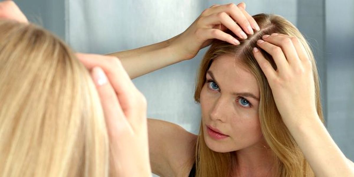 علت نازک شدن و ریزش مو چیست؟