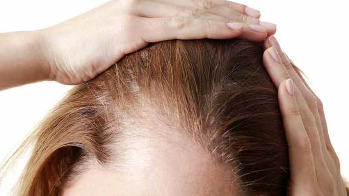 علت نازک شدن و ریزش مو چیست؟
