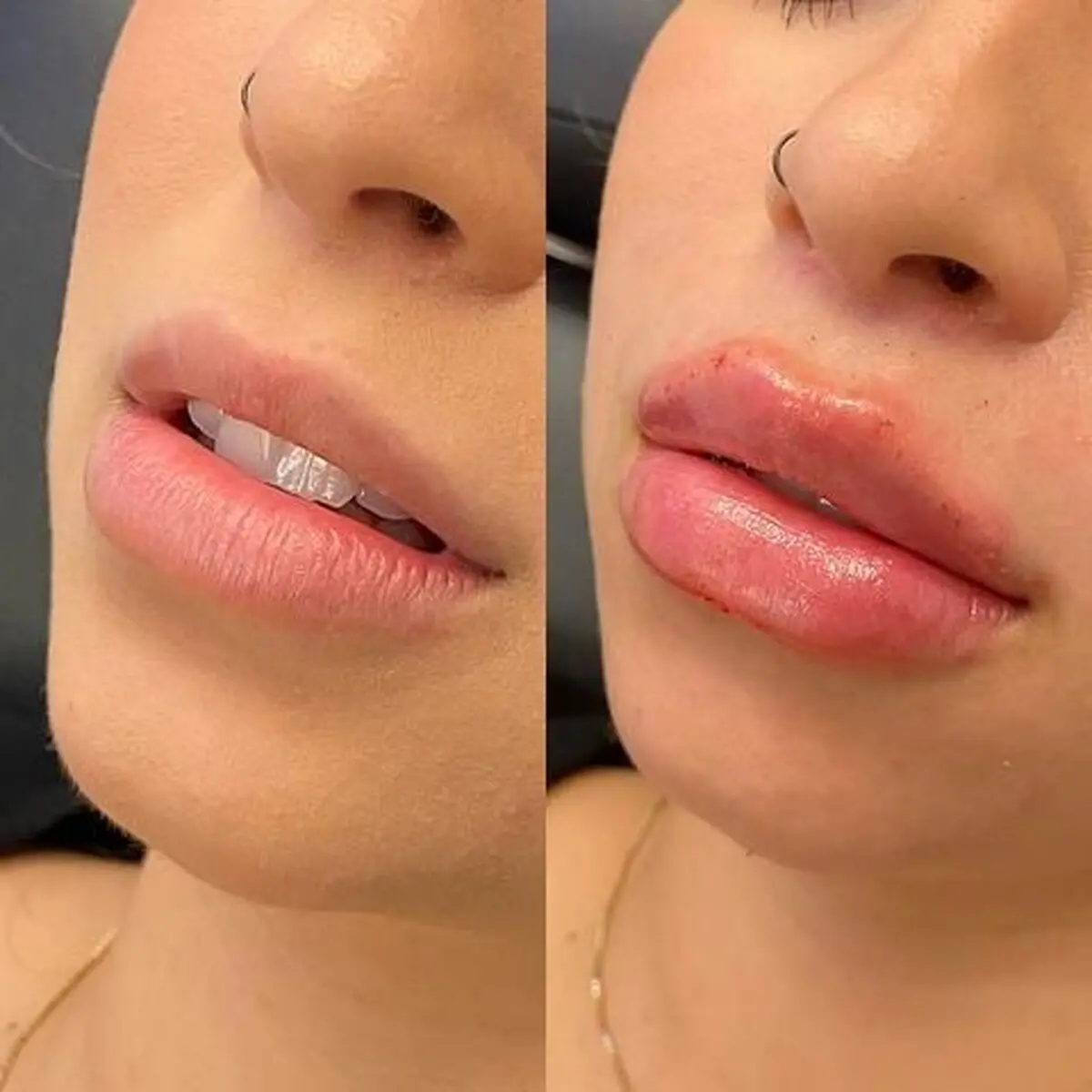 بهترین ژل لب