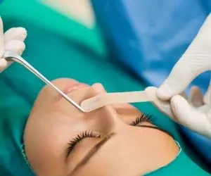 بینی بر باد رفته