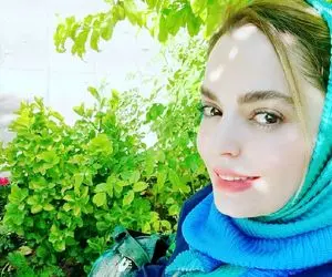 کاهش وزن چشم گیر خانم بازیگر!