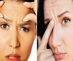 از بین بردن چروک پیشانی با روش خانگی / اینجوری خطایی که حتی با بوتاکسم صاف نمیشن محون