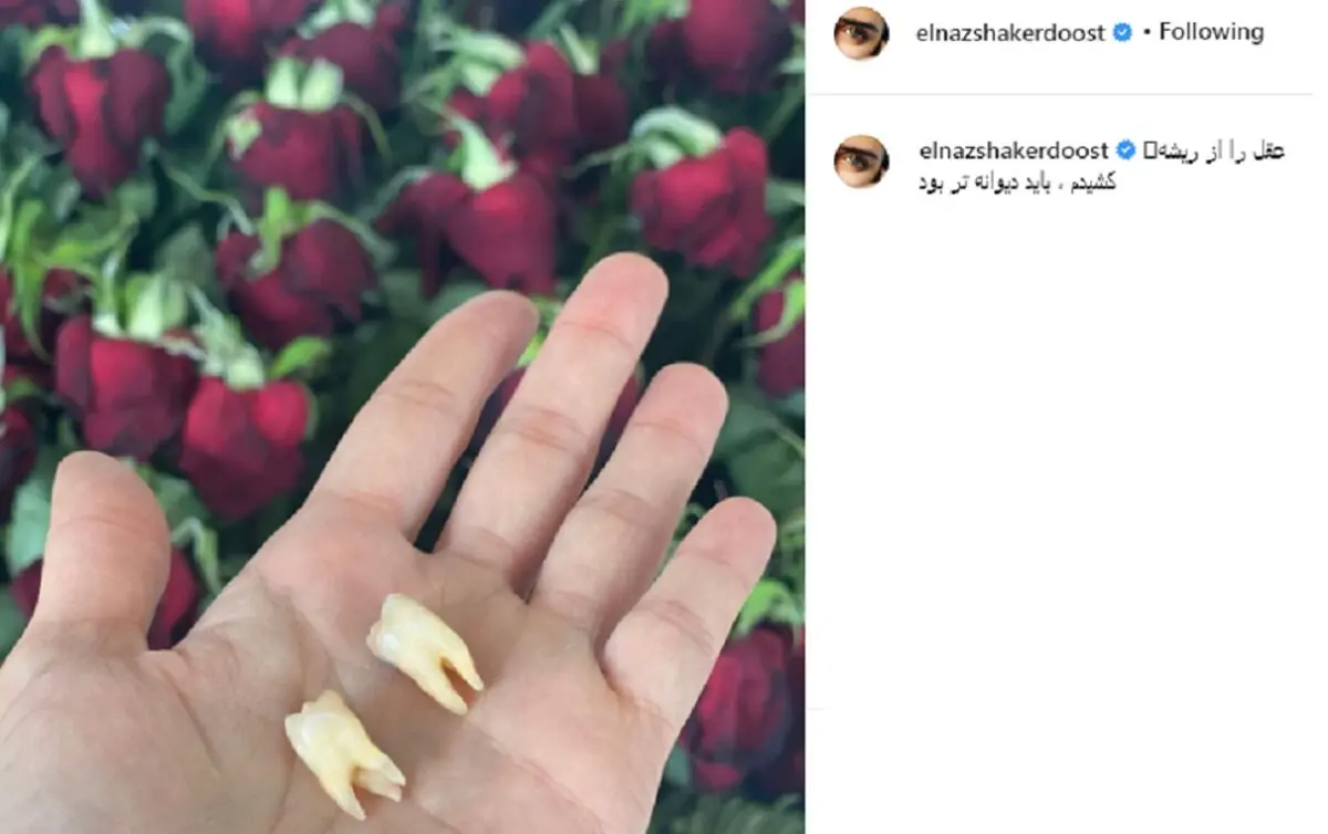 الناز+شاکردوست
