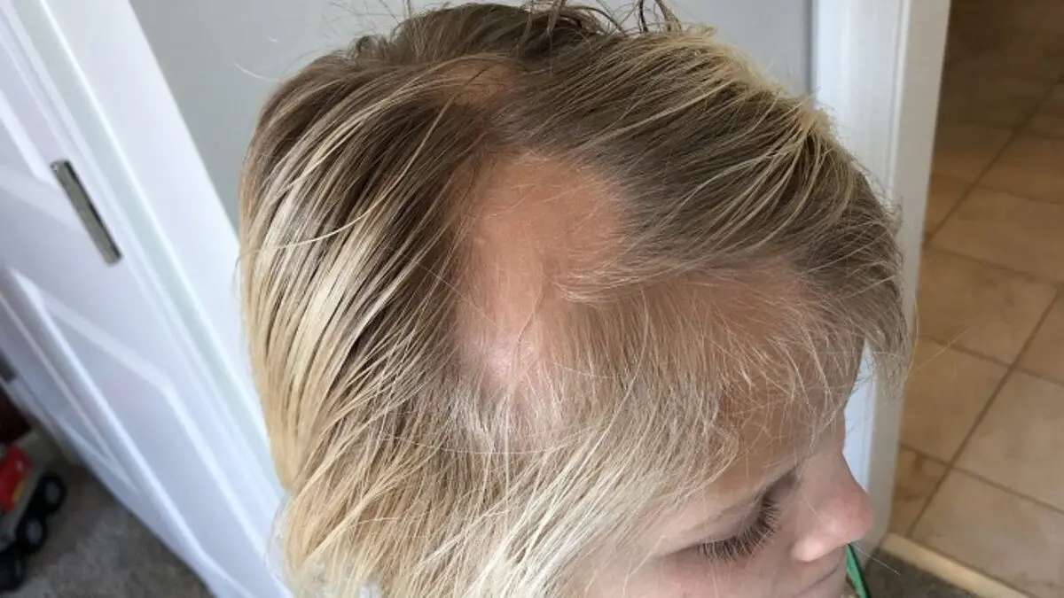 hair4-1280x720