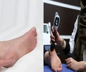 متخصص ترین دکترهای درمان خار پاشنه در کرج / دارای بالاترین میزان رضایت مراجع در البرز