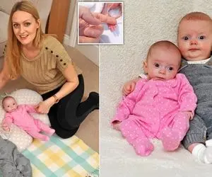 حاملگی نادر و عیجب؛ بارداری دوم یک زن در حین بارداری