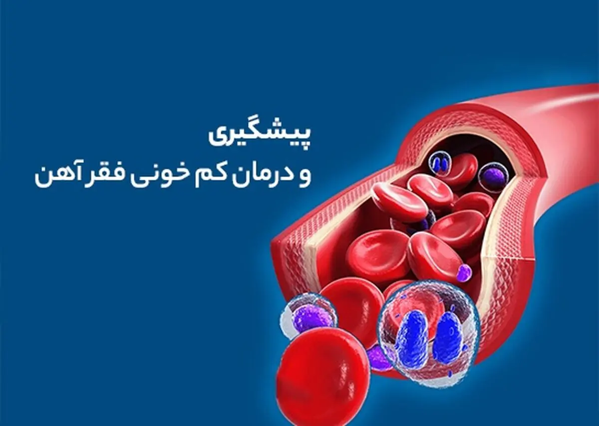 خون2