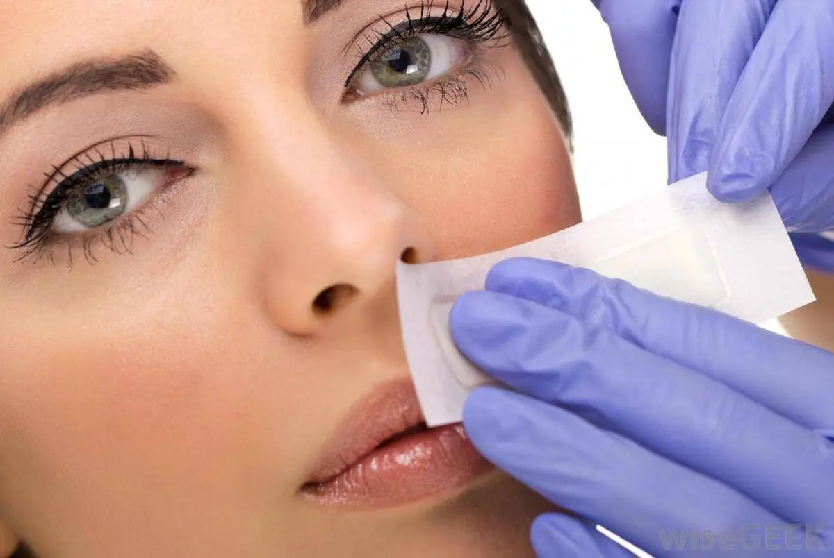 woman-getting-hair-removed-on-face