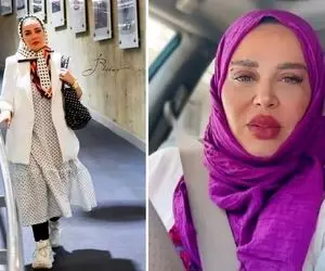 بهاره رهنما بازم رفت زیر تیغ و فیسش شده شلوغ پلوغ / فالوورش این ریختی چه میمیره واسش!