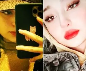 راه درآمد سَرسخت "سارا و نیکا" مایه دارهای سوئد نشین؛ خانوم چه پروتزی کرده!