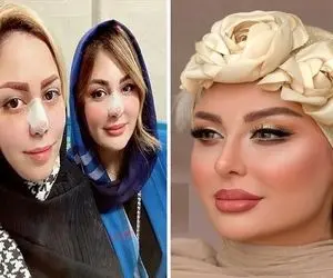 "نیوشا ضیغمی" برا باره دوم دماغشو برد زیره تیغ شد قده فندق؛ چه پپسی باز میکنه برا خودش