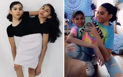 عجایب خلقت؛ خواهرانی که از ناحیه شکم به هم چسبیده‌اند!عجیبن اما درسخون و دوست‌داشتنی 