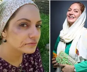 تغیر چهره زیاد"مهناز افشار" تو آلمان؛ اینستاگرام تنها ابزار ارتباطی