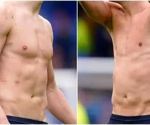 بدن بدون لباس هالند و یری مینایی که حسابی زخمی اش کرد!