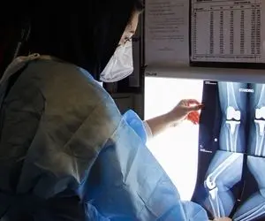 جلوگیری از پوکی استخوان؛ رادیولوژی تابا | نوبت فوری آنلاین، پوشش بیمه