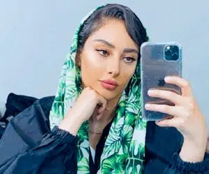 لب های برجسته و آرایش خاصی که ترلان پروانه را زشت کرد!