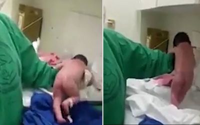 (ویدیو) ماجرای نوزادی که بعد از تولد راه رفت!