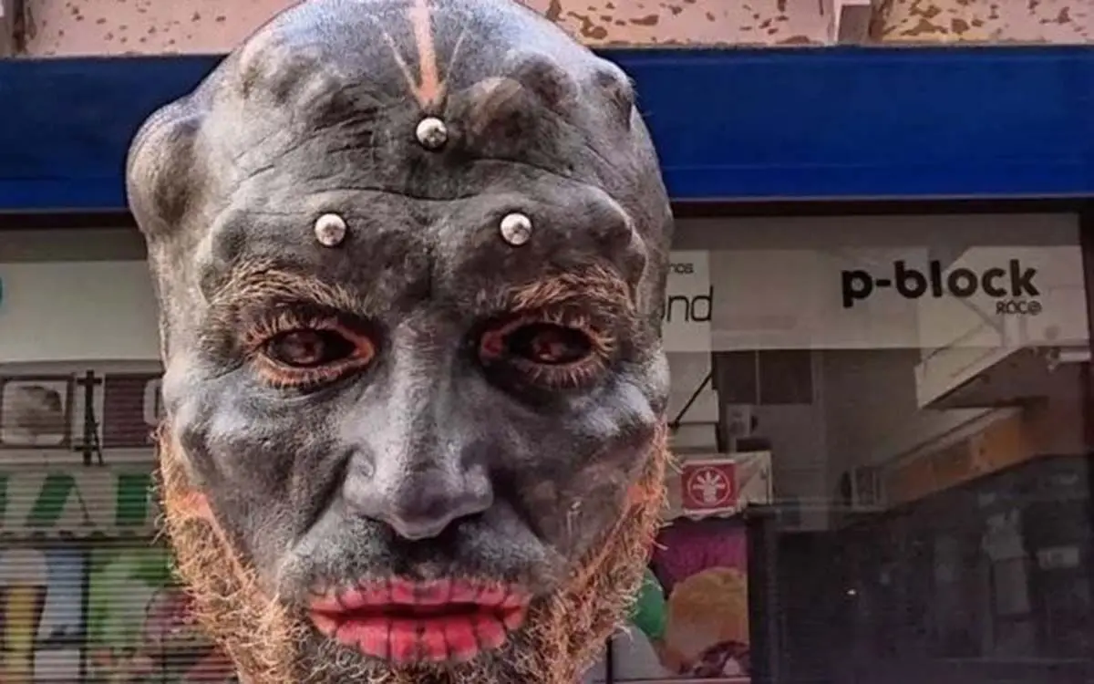 1_Man-who-removed-nose-to-look-like-alien-has-now-sliced-his-top-lip-off-in-shocking-body-modification