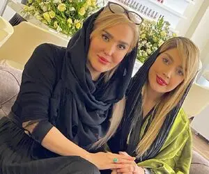 (عکس) زهره فکور صبور بعد از عمل زیبایی صورتش؛ زشت شد!