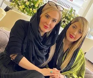 (عکس) زهره فکور صبور بعد از عمل زیبایی صورتش؛ زشت شد!