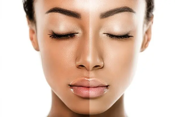 How to lighten skin tone?
