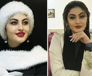 چهره پُر و پِیمون "مریم مومن" که با ژل لب کیلوییش شد خفاش شب؛ مغرور کی بودی تو!