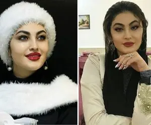 چهره پُر و پِیمون "مریم مومن" که با ژل لب کیلوییش شد خفاش شب؛ مغرور کی بودی تو!