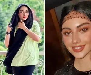 ترلان پروانه انگاری خودش فیسشو تو مواد میخوابونه؛ خانوم ته هر چی عمل مملِ در آورده!