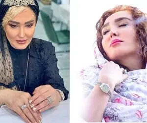 "زهره فکور" موهاشم خالی بندی و پوستیژ بود؛ با اینهمه تغییر شبیه عروسکا شده!