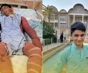 دستور ویژه وزیر برای مداوای علی لندی پسر فداکار دهه هشتادی