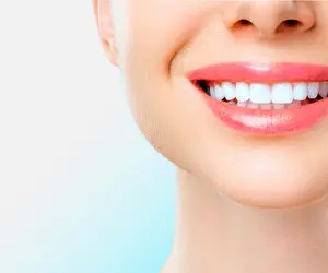 همه چیز درباره لمینت دندان؛ از مزایا تا عوارض آن