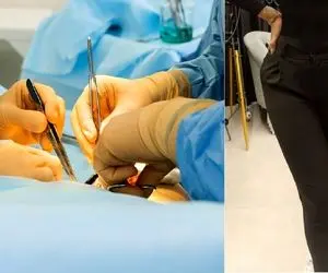 (فیلم) مرگ سه زن که می خواستند با جراحی زیبایی خوشگل شوند اما....