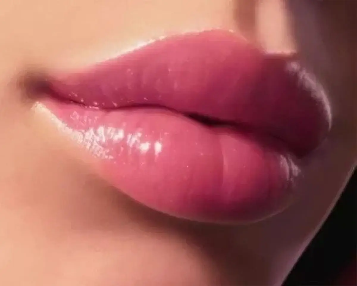 رز2