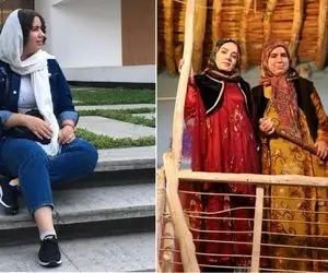 عکسای ژورنالی روناک نون خ که مخاطبارو شوکه کرد؛ باهوشیه خانوم وقتی بی پروتز شد شاخ!