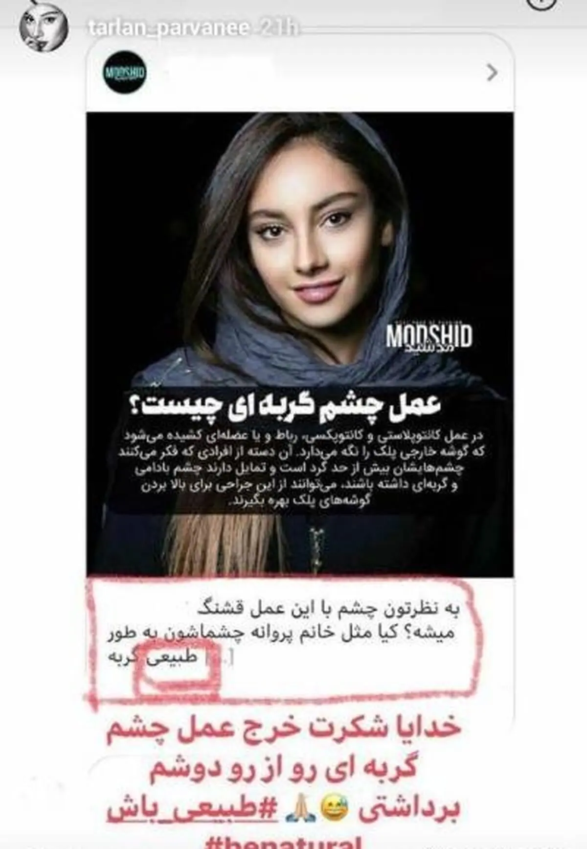 ترلان-پروانه