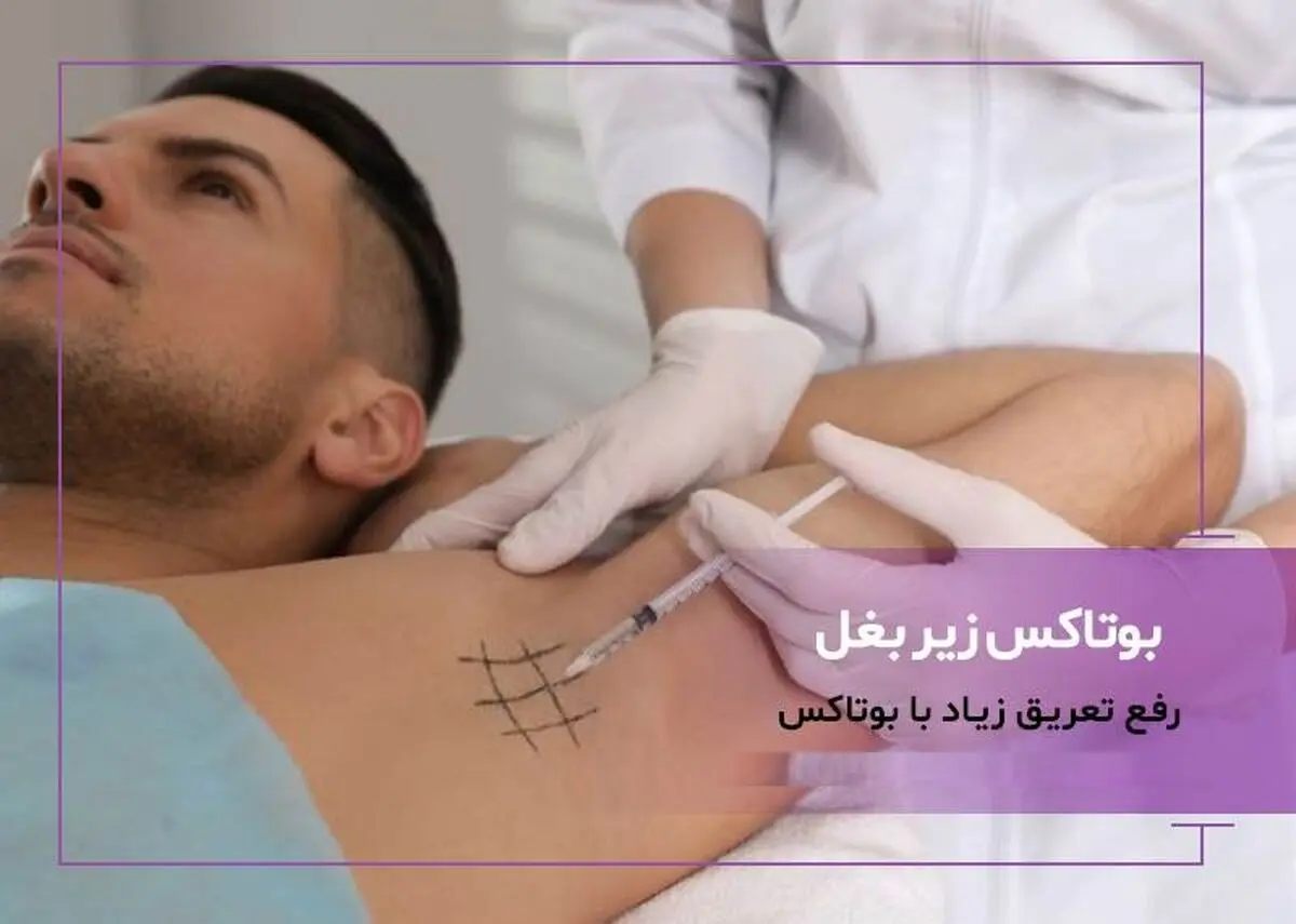بوتاکس