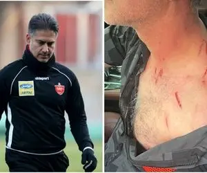 جزئیات حمله سارقین خشن به حمید مطهری و دزدیدن گردنبد طلا