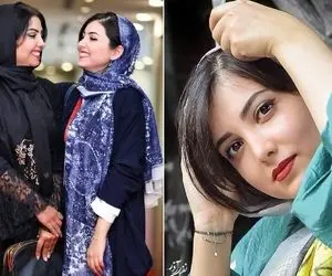 زیبا کرمعلی رفت خوشگلاسیون اما یه جور شده ناجور؛ خانوم بعد دینامیت چه فوکولی شده!