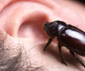 آن روی طبیعت وحشی؛ سوسک رفته تو گوش مرد بخت برگشته حالا دارن با هزار بدبختی درش میارن