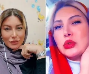 "فریبا نادری" تو استوری خودشو واسه شوهرش لوس کرد؛ با عمل بینی چی بودی چی شدی!