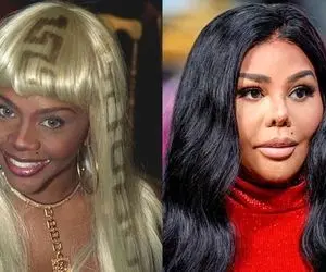 گران ترین جراحی های پلاستیک سلبریتی ها