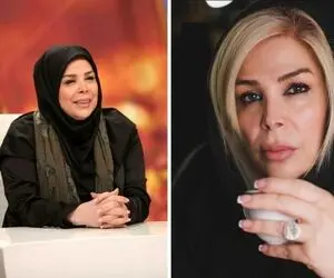 آرایشگر شیواخنیاگر از خانوم جَوون ساخت در حد 20 سال؛ با خروار ژل و بوتاکس شد یکی دیگه