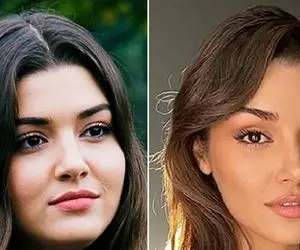 دوست دارم صورتم تو پر شه چیکار کنم؟ / واسه چاق شدن صورتت سوزن نزن اینجوری خونگی بهتره