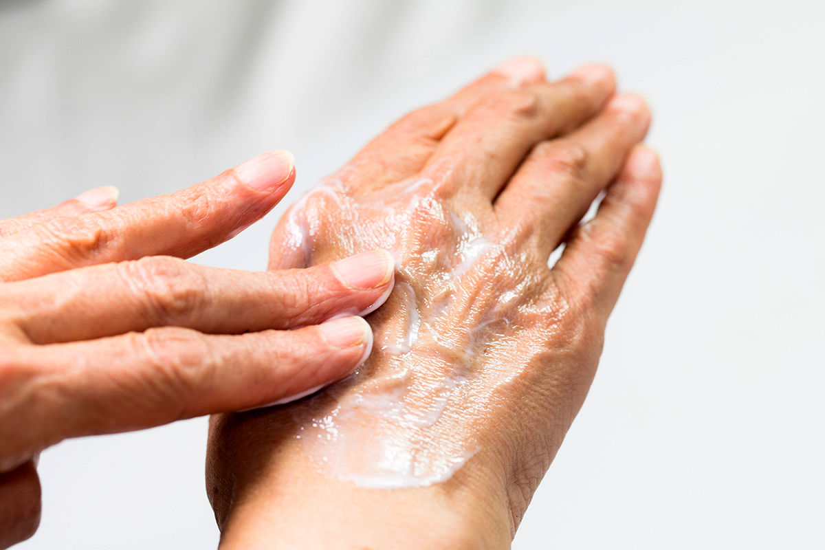 frequent-hand-washing-hand-dermatitis